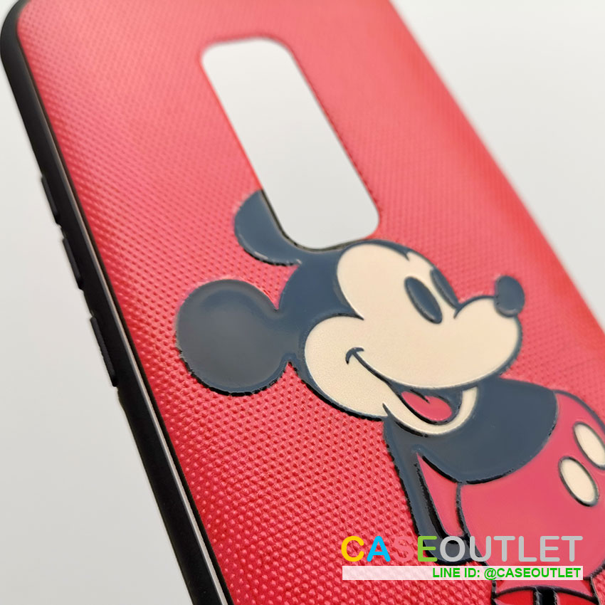 เคส vivo V17pro ขอบยาง ลายผ้า Mickey มิ๊กกี้